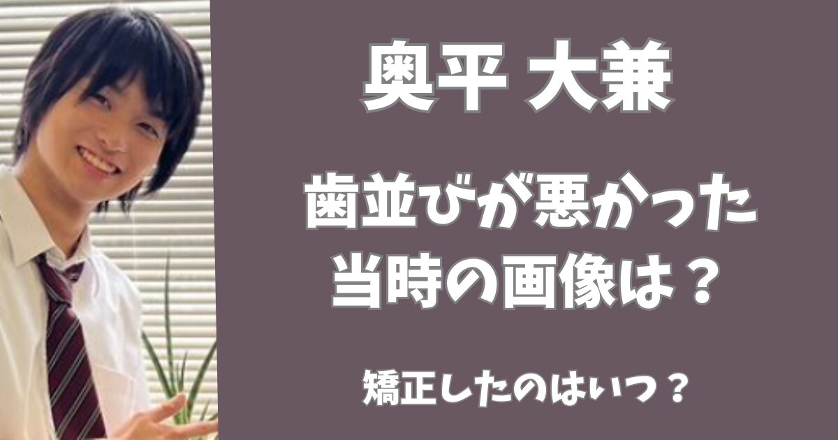 奥平大兼の歯並びが悪かった当時の画像は？